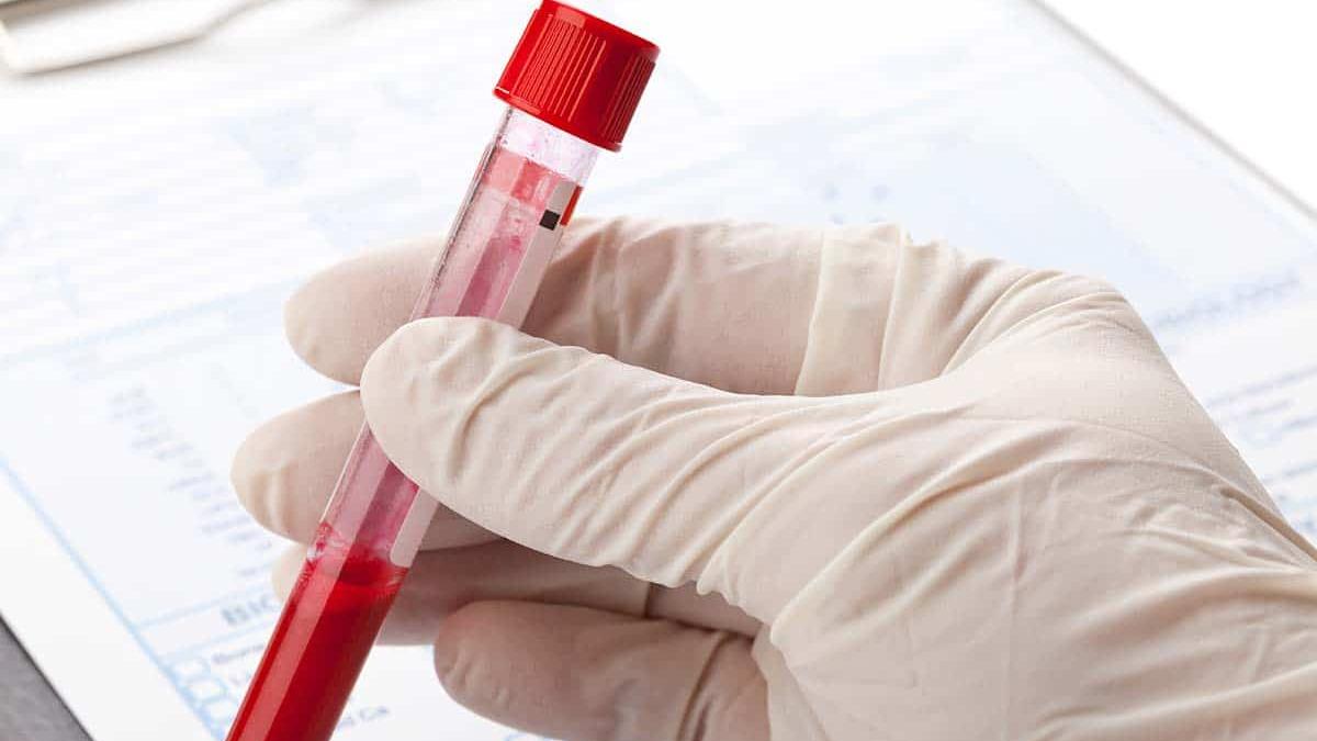 Lucca, test negativi sul paziente rientrato dal Congo