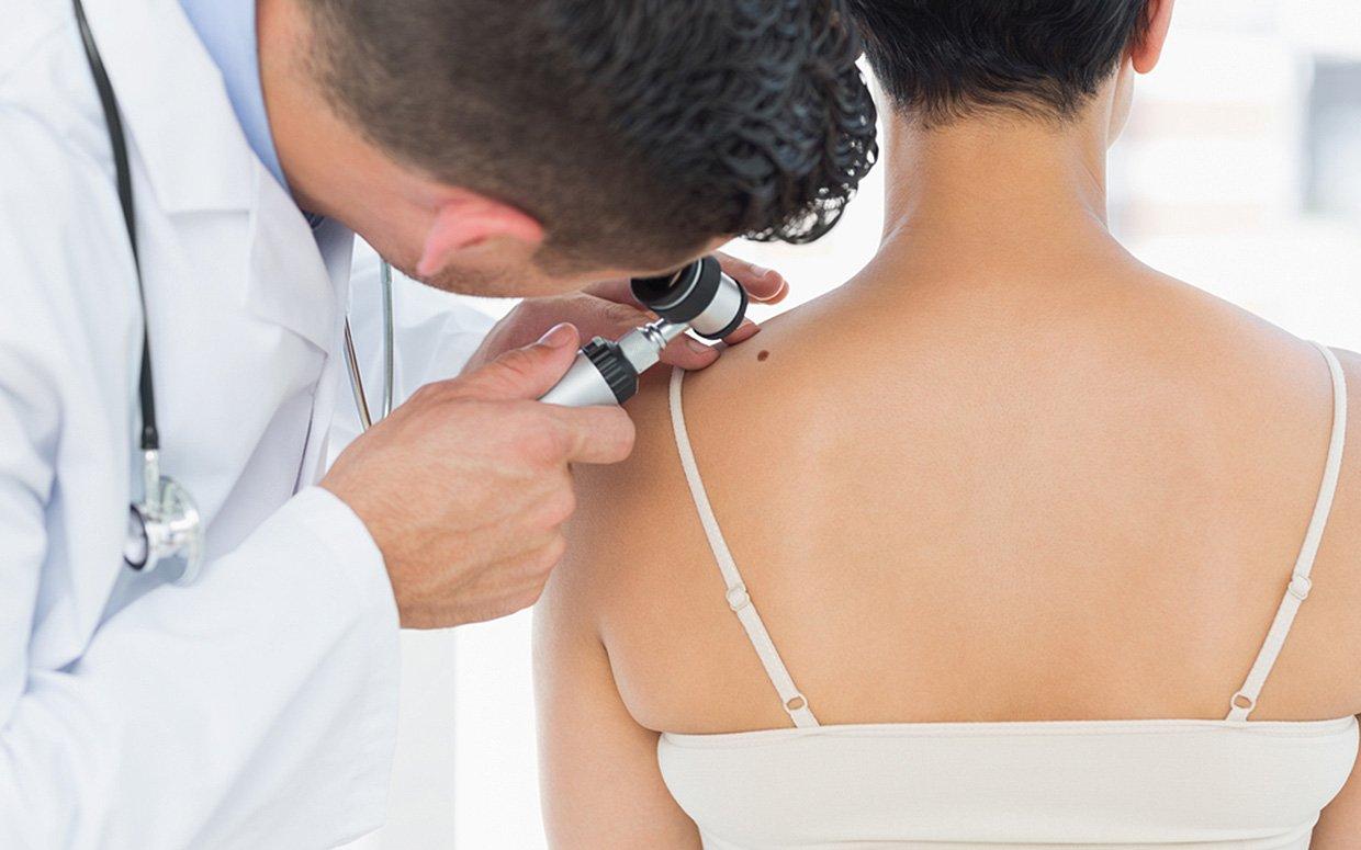 
	Una visita dermatologica (foto d'archivio)

