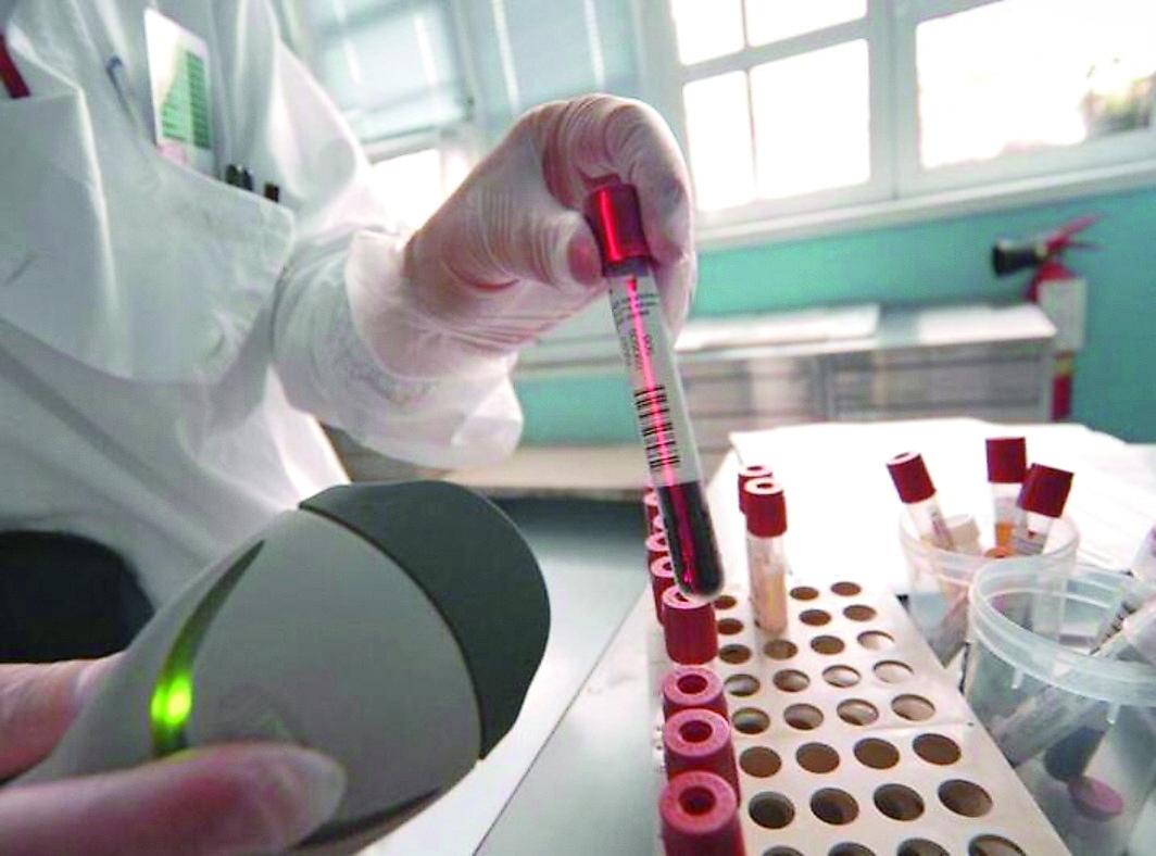 L’epatite dilaga tra gli “invisibili” di Prato, corsa contro il tempo per curarli