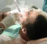 Lucca, gravi errori nelle cure dentali: dentista condannata a risarcire la paziente