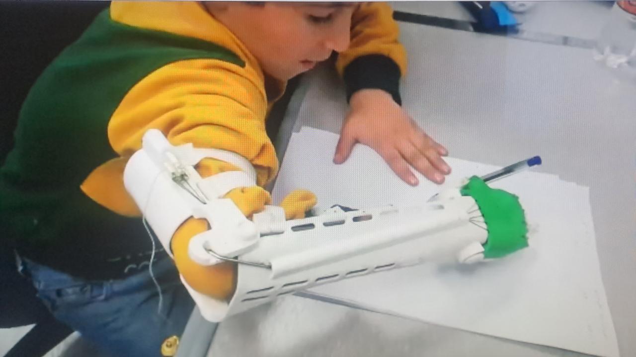 I bambini mutilati della Siria tornano a scrivere grazie alle protesi di Amar
