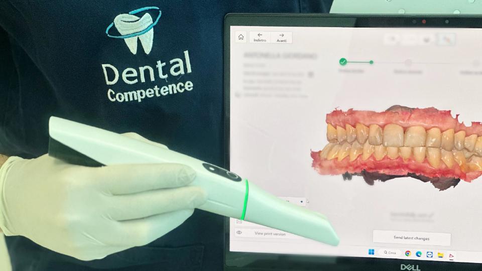 L'innovazione nel tuo sorriso: lo scanner intraorale di Dental Competence Grosseto