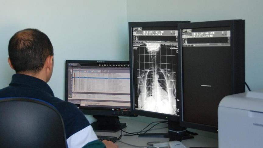 Radiologia: attesa infinita 5 mesi per un’ecografia