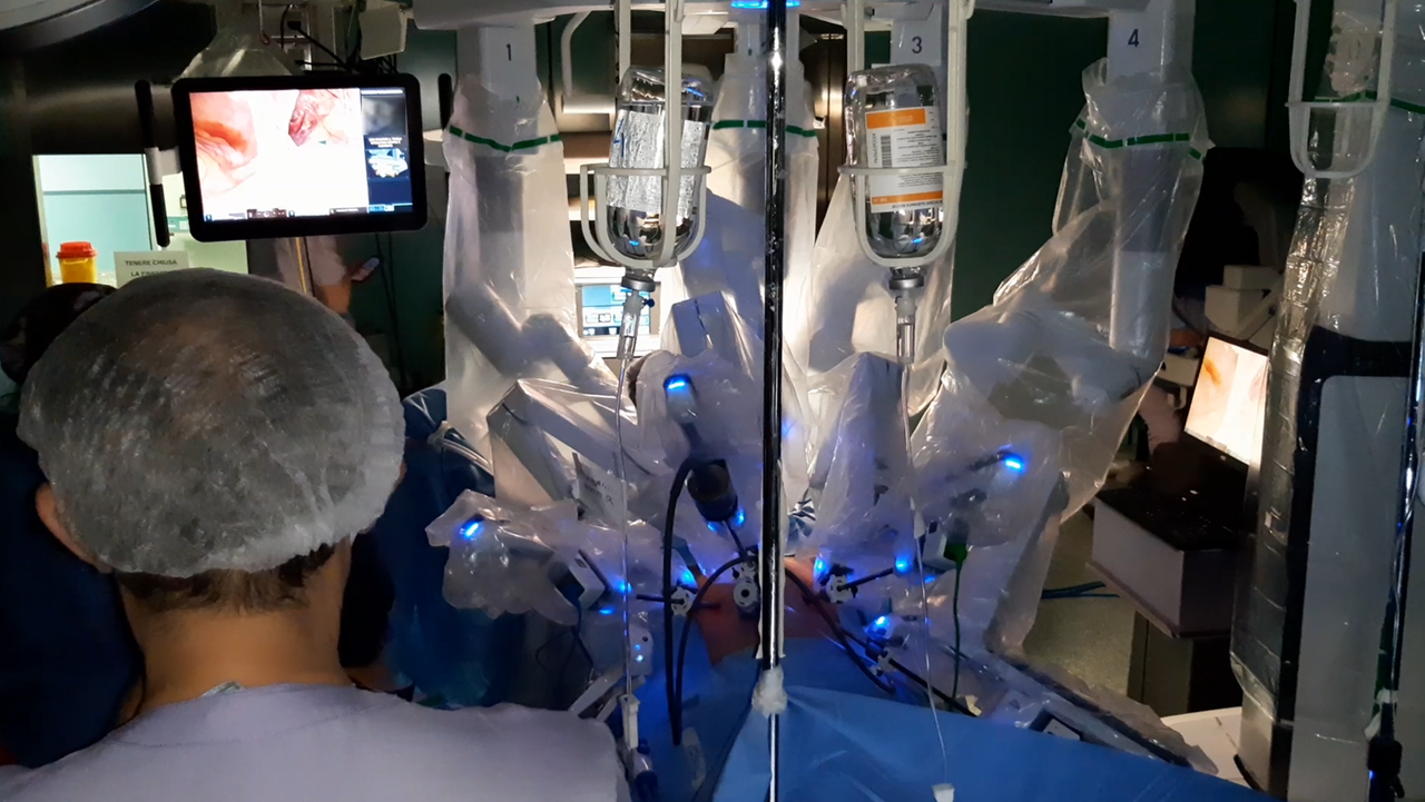 Chirurgia da record a Sassari, primo intervento robotico su un bambino in Sardegna