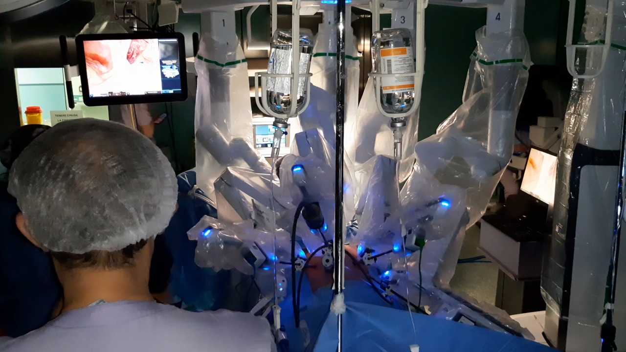 Chirurgia da record a Sassari, primo intervento robotico su un bambino in Sardegna