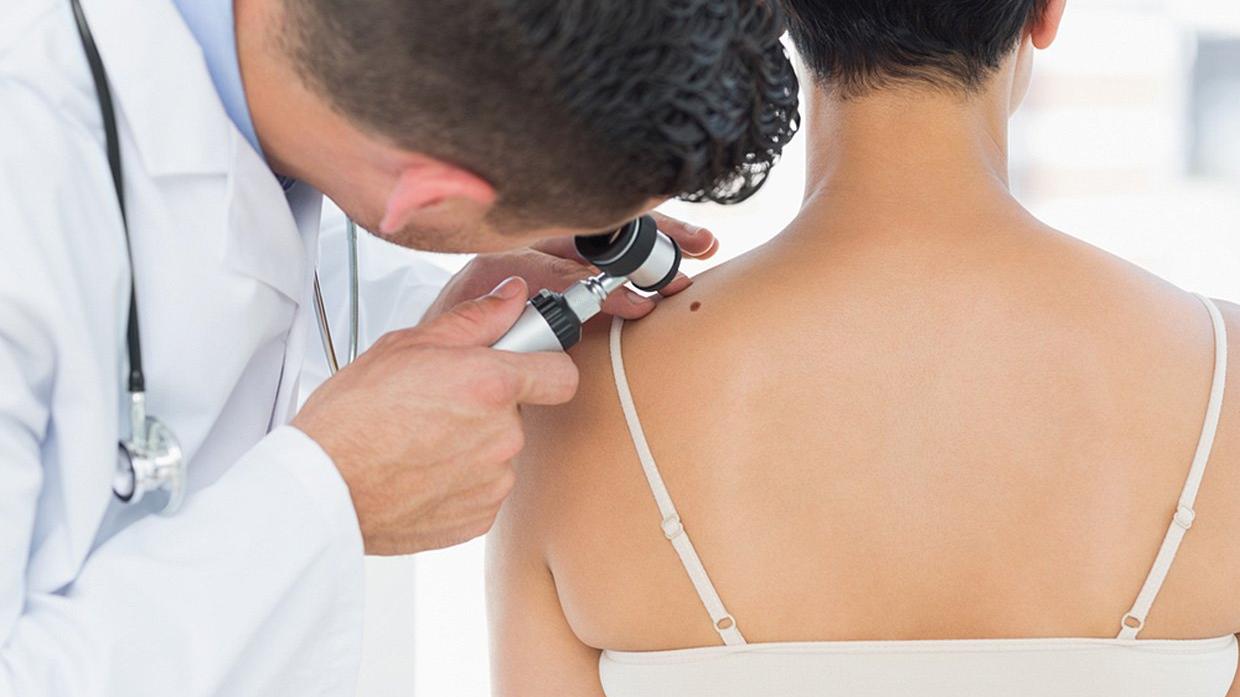 Una visita dermatologica (foto d'archivio)