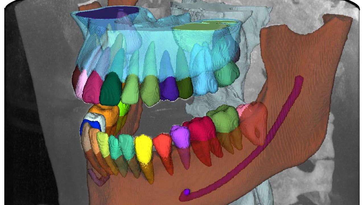 Una soluzione proposta dall'intelligenza artificiale