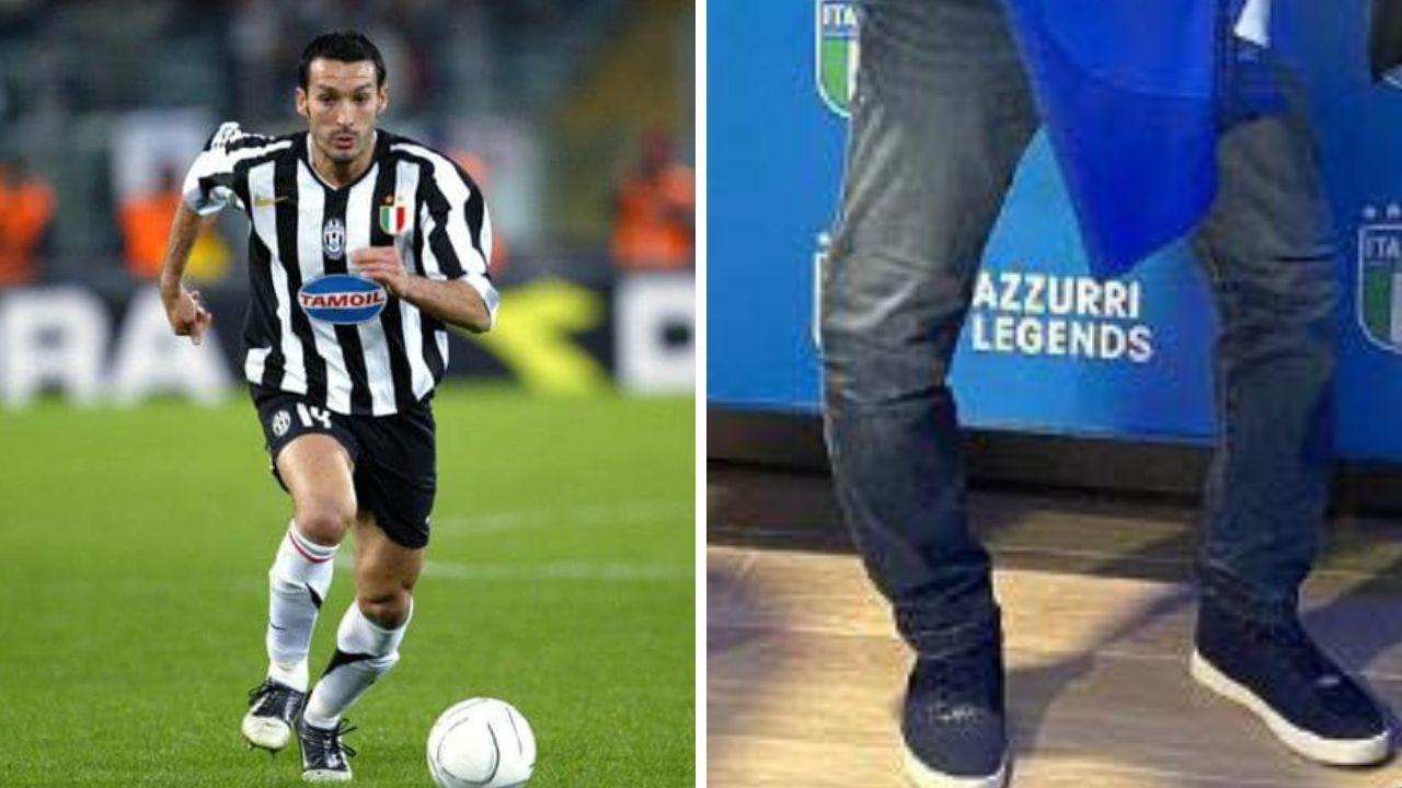 Zambrotta e le gambe curve, le difficoltà per camminare e le possibilità di recupero secondo l'ortopedico toscano