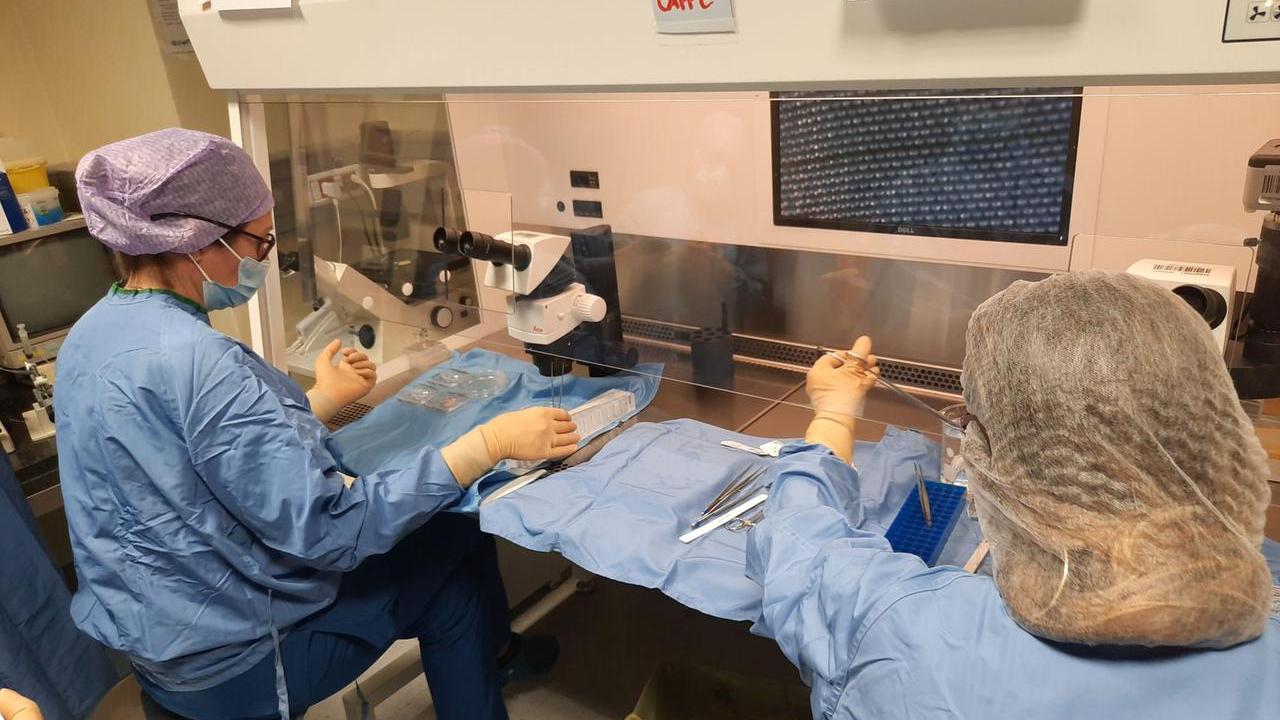 Il tessuto ovarico è stato scongelato e reimpiantato