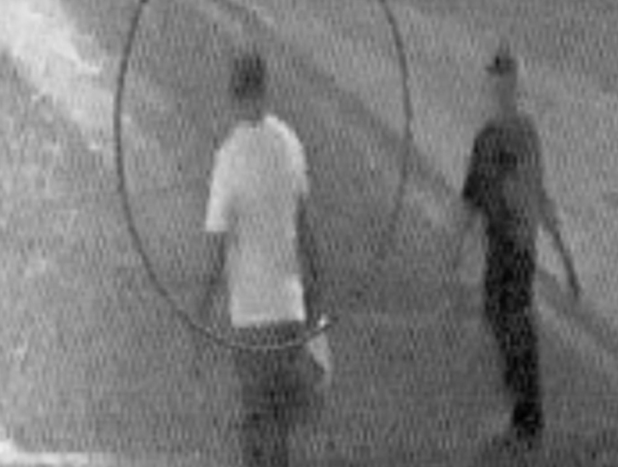 Un fermo immagine degli istanti prima dell'aggressione