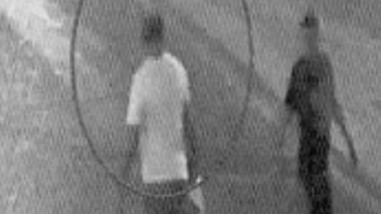 Un fermo immagine degli istanti prima dell'aggressione