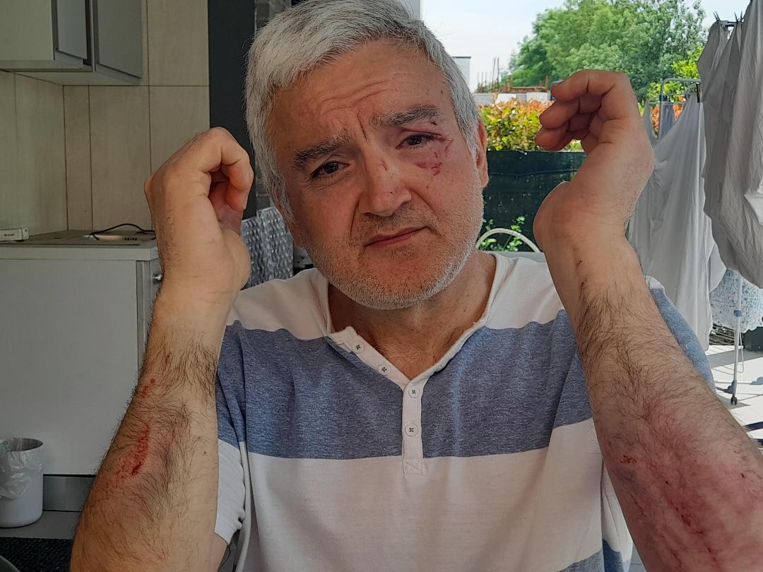 Aggressione nel quartiere Acque Chiare: «Preso a badilate dal balordo che ci terrorizza da oltre un anno»