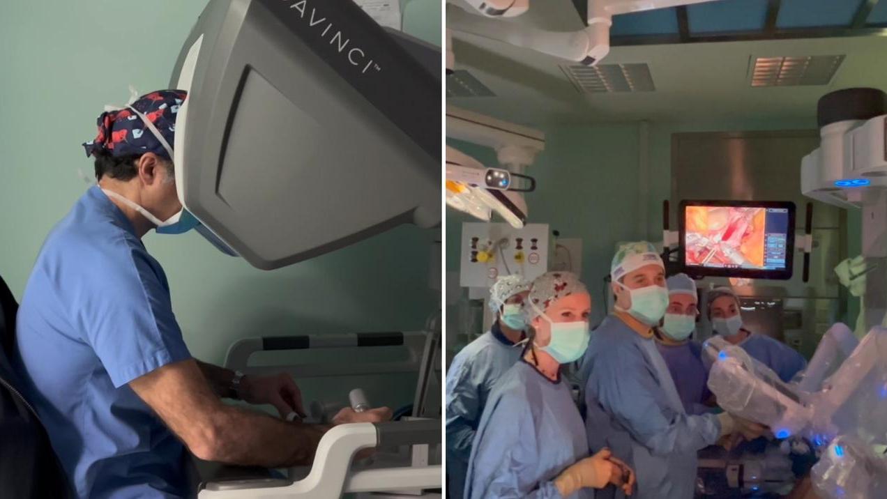 Il Policlinico fa scuola nel mondo: primo trapianto di emifegato con approccio totalmente robotico