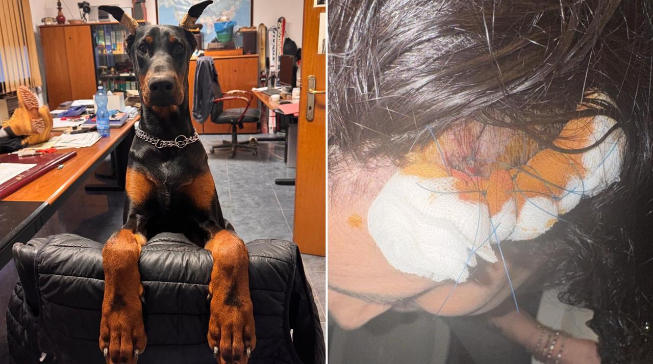 
	Il dobermann Attila e la donna ferita

