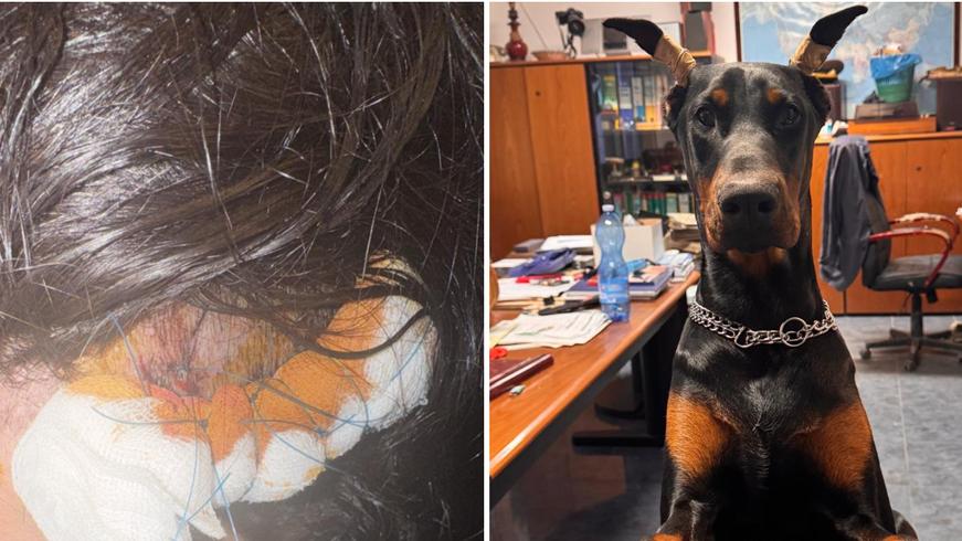 La ferita alla testa di Sonia, a destra il dobermann Attila
