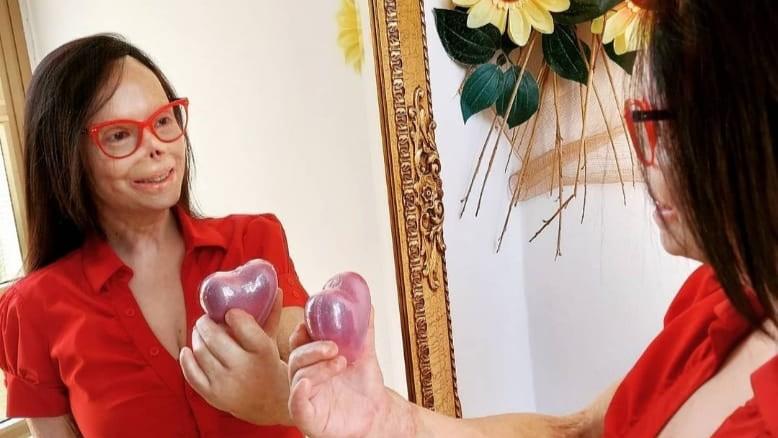 Valentina Pitzalis: «Sono quasi morta e sorrido, ora aiuto le altre a salvarsi»