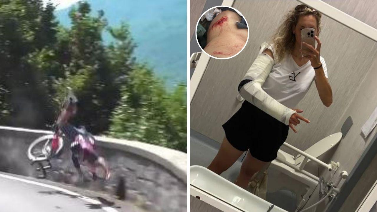 
	La caduta&nbsp;di Vittoria Guazzini, a dx la ciclista col braccio fasciato e le ferite che ha riportato (foto Instagram / Vittoria Guazzini)

