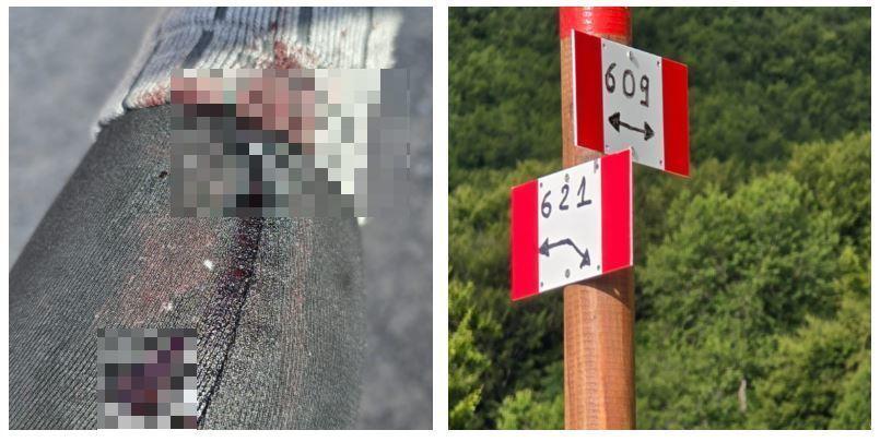 La denuncia di una escursionista: «Accerchiata da quattro cani a guardia del gregge: uno mi ha morso»