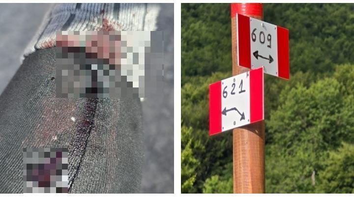 La denuncia di una escursionista: «Accerchiata da quattro cani a guardia del gregge: uno mi ha morso»