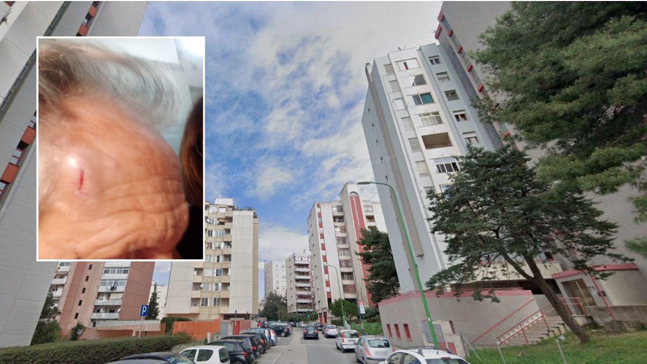 Assalito sotto casa da un 13enne: «Prima mi ha detto “buongiorno”, poi mi ha tirato un sasso al volto»