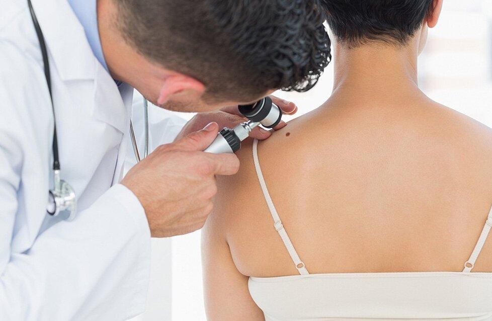 
	Una visita dermatologica

