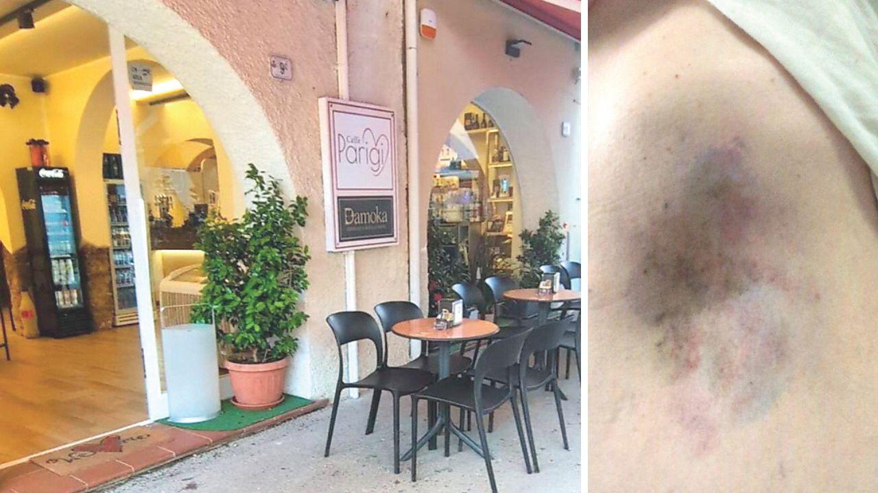Il locale in cui è avvenuta l’aggressione e uno dei lividi sulla pelle della titolare