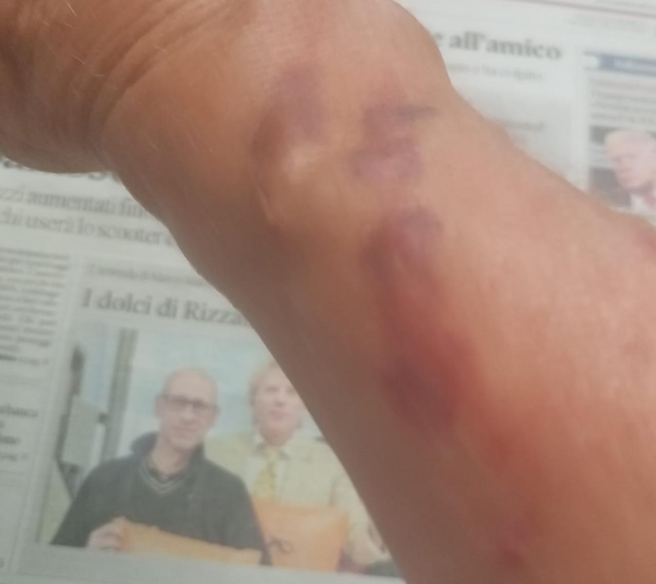 Trambusto a Fiscaglia. Donna picchiata dalla vicina di casa