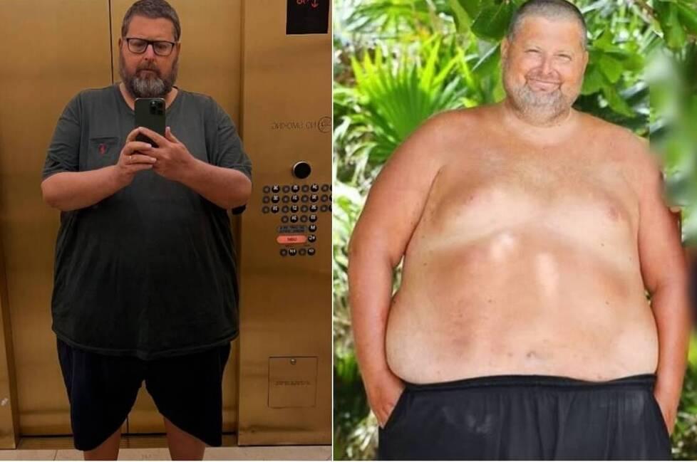 Nelle foto il prima e dopo di Adinolfi