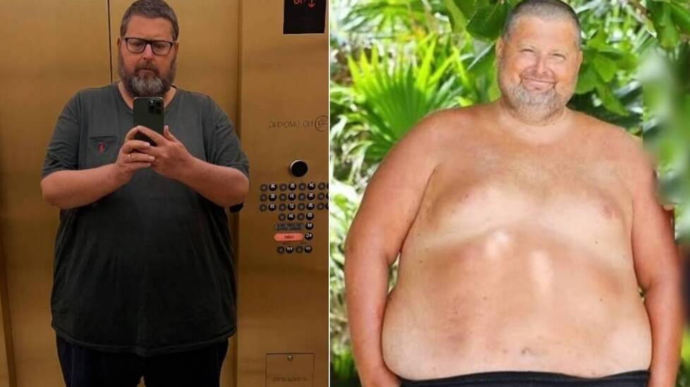 Nelle foto il prima e dopo di Adinolfi