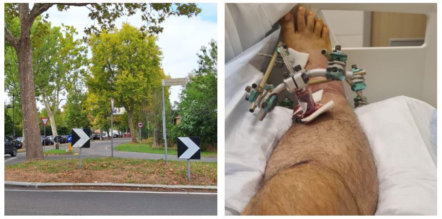 «Mio marito investito, picchiato e sfregiato col coccio di una bottiglia senza un perché»