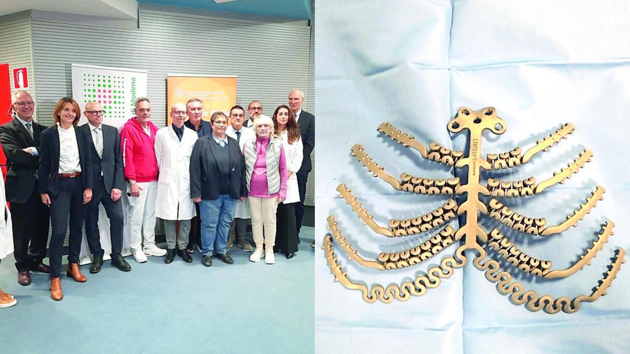 Sostituito lo sterno a una paziente a Baggiovara, solo tre interventi simili in Italia