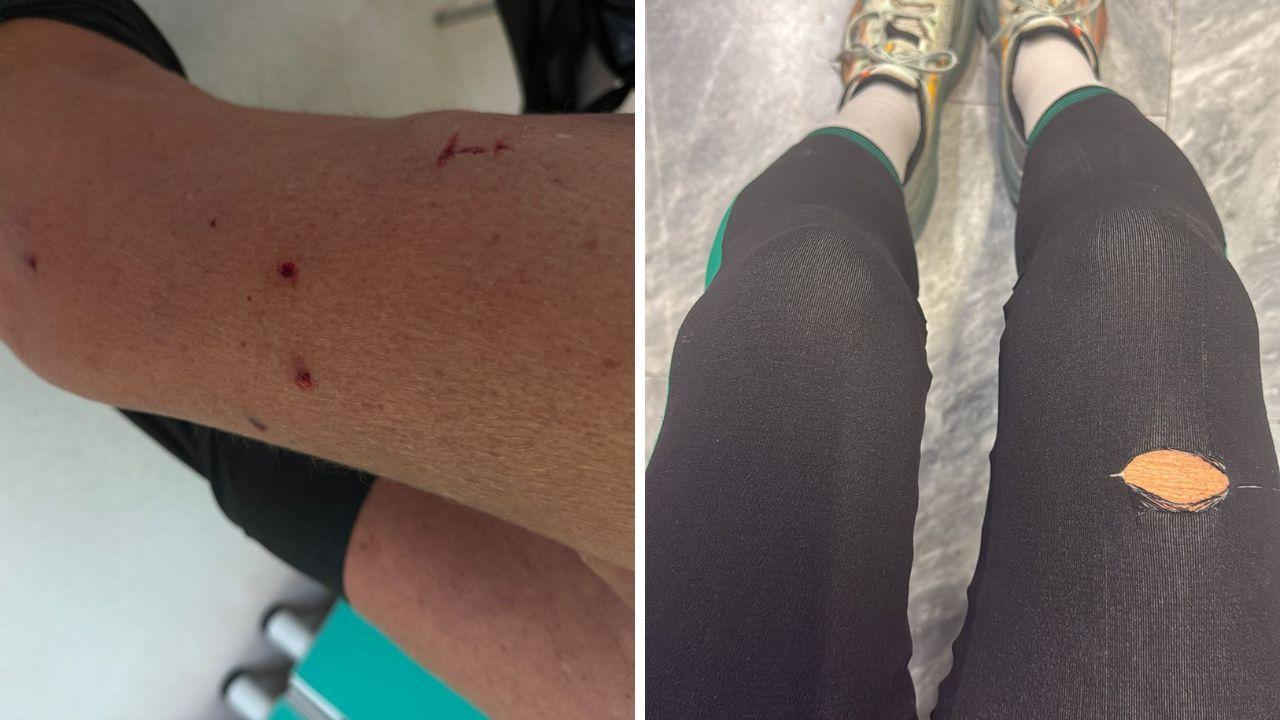 Le immagini delle ferite