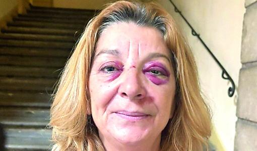 Elisabetta Brunelli con i segni evidenti dell'aggressione