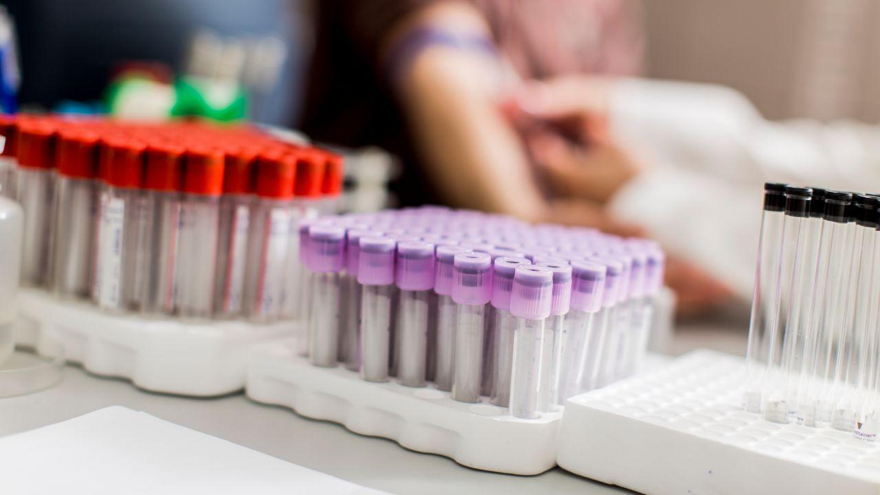 
	Coas prelievi a Livorno e Pisa

