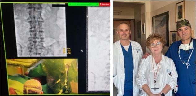 Non riusciva più a mangiare a causa di una grave malformazione: 72enne salvata dai medici dell’ospedale Santa Maria