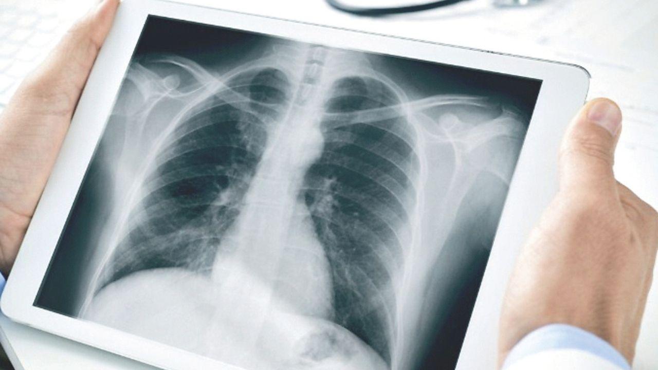 
	Allarme polmonite&nbsp;

