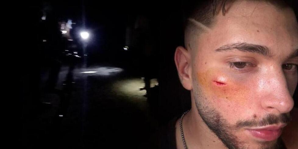 
	Leonardo Pistoia dopo l&rsquo;aggressione denunciata nei mesi scorsi

