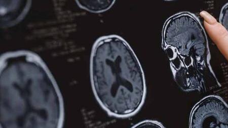 La donna si era presentata in pronto soccorso con un forte mal di testa (foto d'archivio)