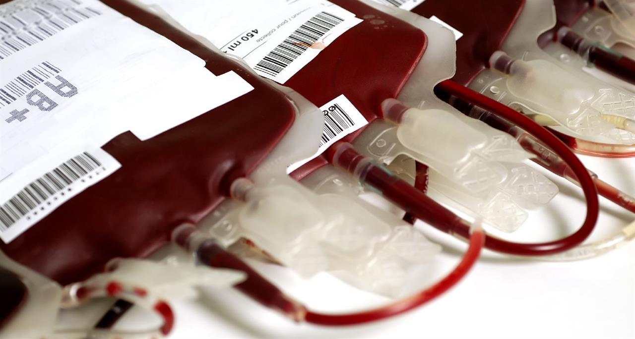 Addio alle trasfusioni: in Sardegna la prima terapia genica per la beta-talassemia