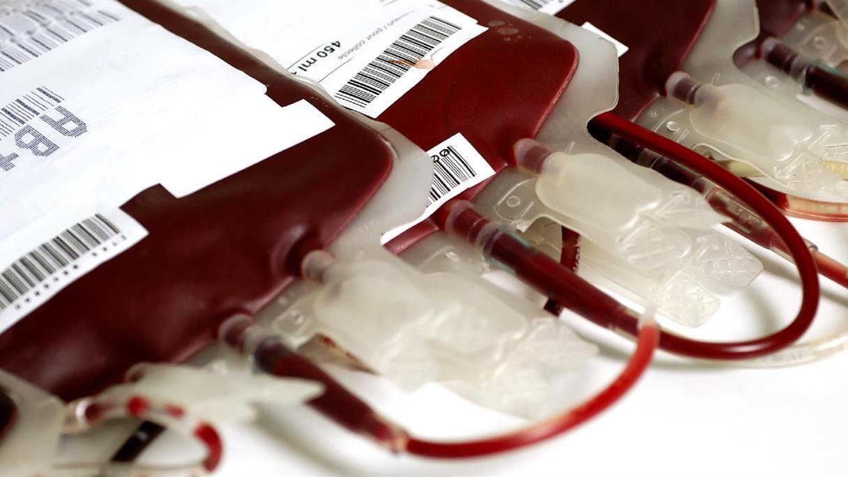 Addio alle trasfusioni: in Sardegna la prima terapia genica per la beta-talassemia