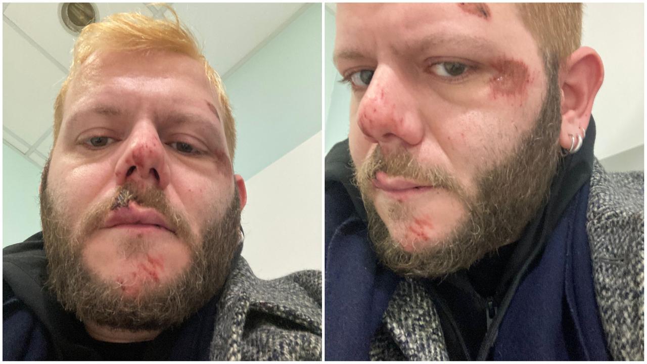 
	&nbsp;Francesco Cavicchioli, il ragazzo aggredito

