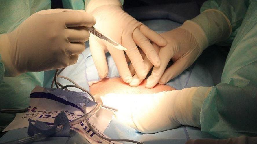 Sassari, bimbo ferito durante il parto cesareo: il caso approda in tribunale