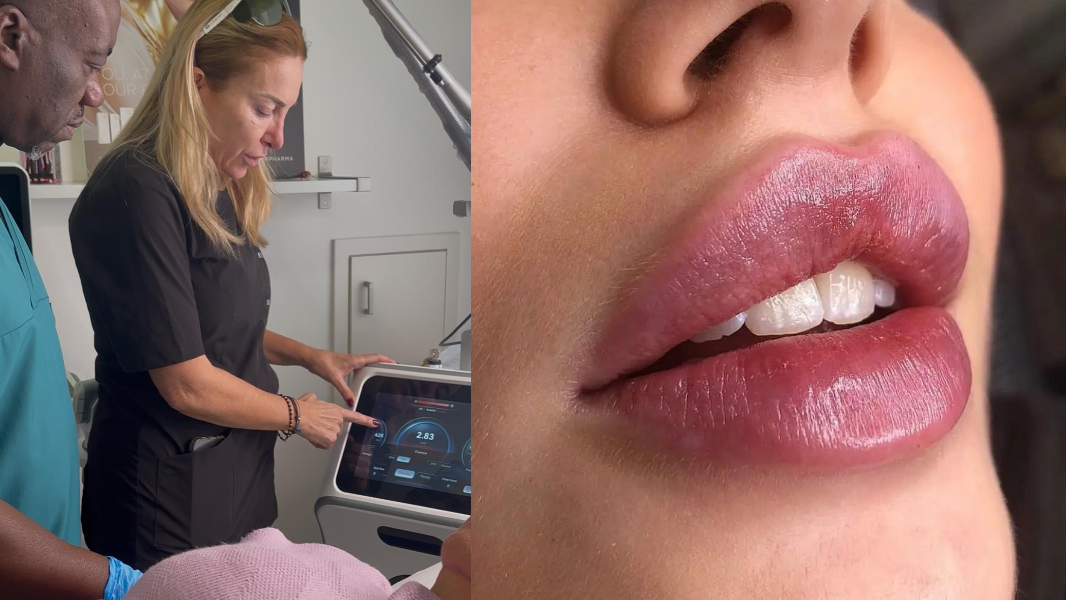 Medicina estetica, basta eccessi: ecco il medico che dice “no” ai volti-format di Instagram – Le storie di chi si è pentito