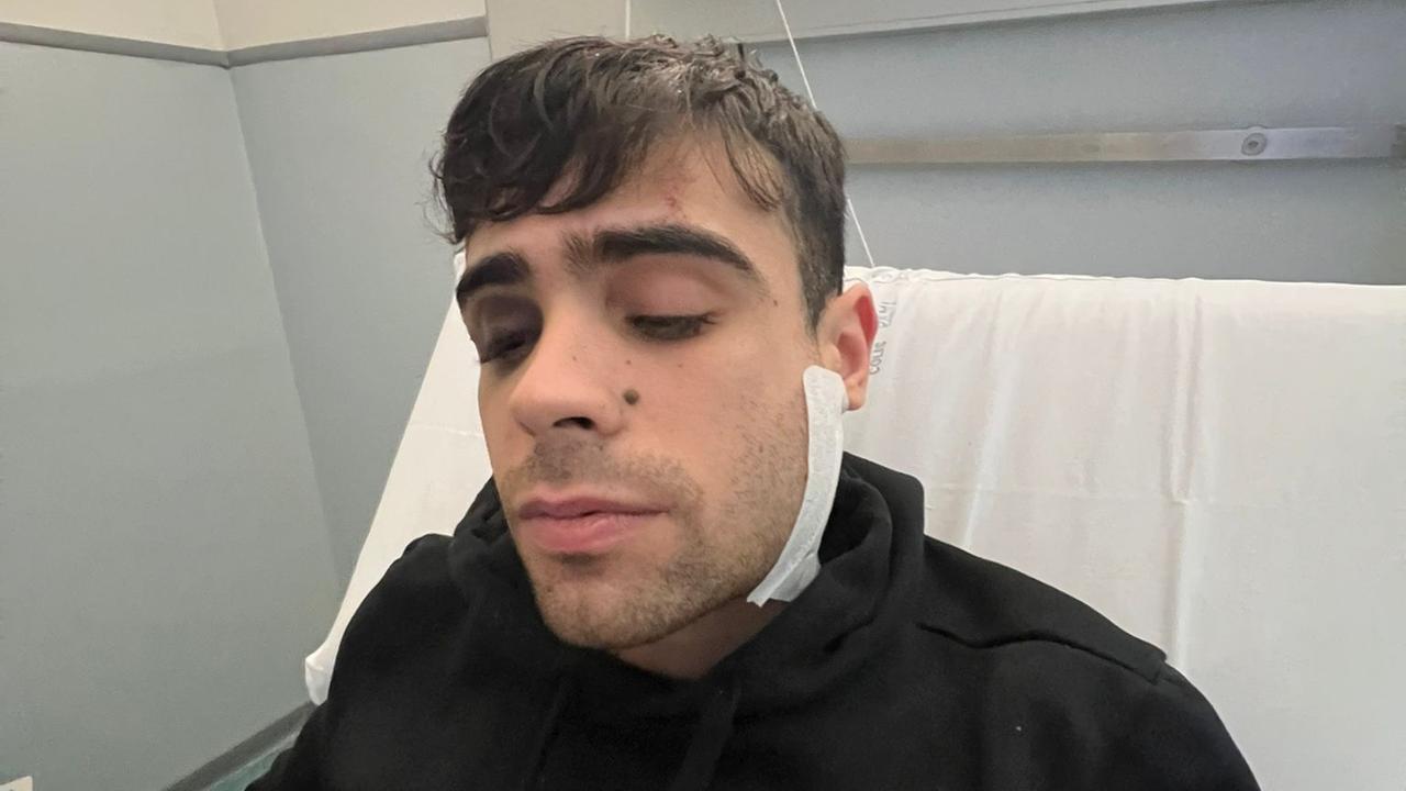 Il ragazzo aggredito dalla baby gang a Sassari: «Pestato senza motivo, ho paura di incontrarli»