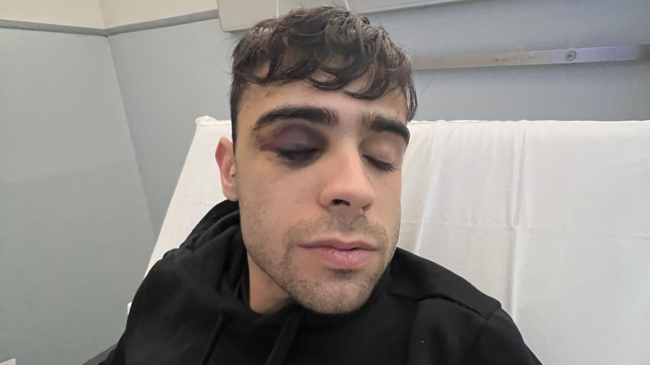 Sassari, Andrea Coroforo picchiato selvaggiamente dal branco: «Ricordo i calci in testa, le urla della mia amica, poi il buio» – VIDEO