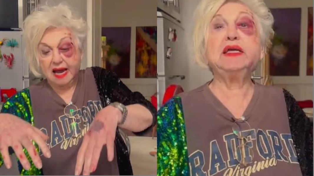 Wanna Marchi investita a Milano: «L’auto, i sassi, un dolore incredibile. Potevo morire»