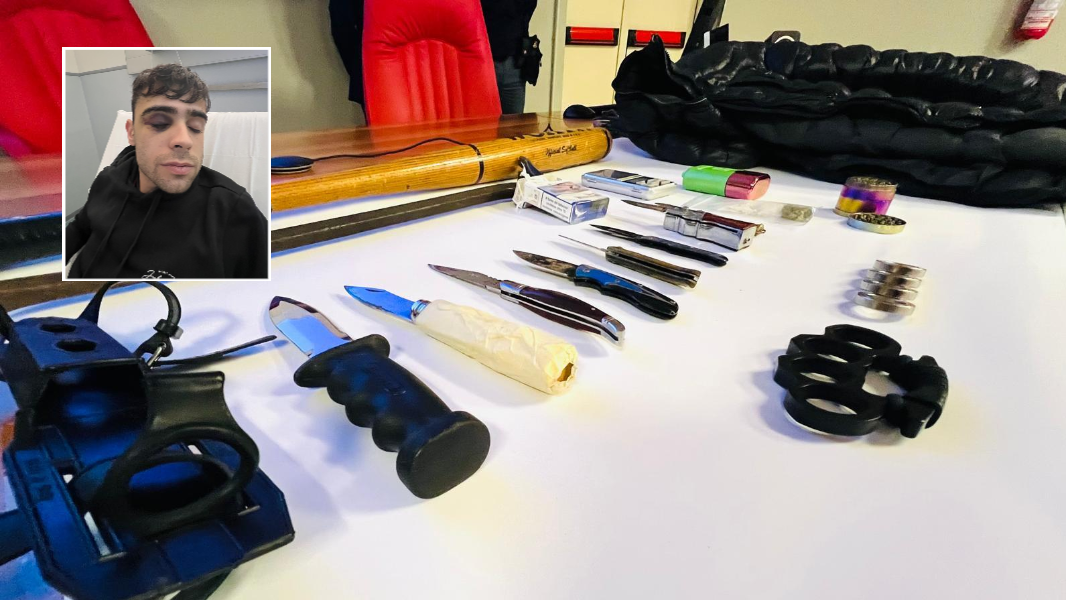 Arrestata la baby-gang di Sassari, la reazione di Andrea massacrato senza motivo: «Nessuna vendetta, voglio solo tornare alla mia vita»