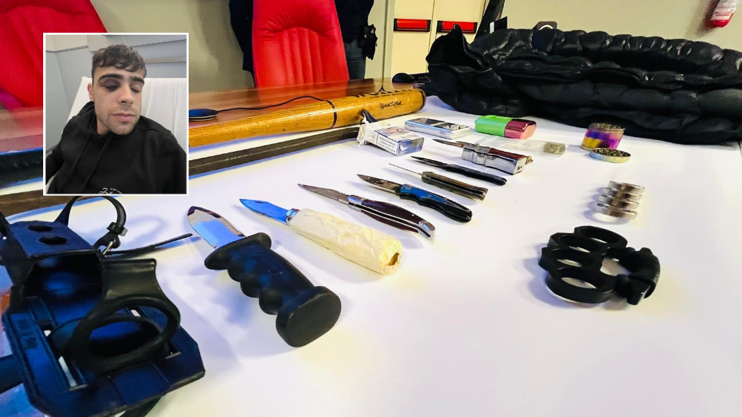 Arrestata la baby-gang di Sassari, la reazione di Andrea massacrato senza motivo: «Nessuna vendetta, voglio solo tornare alla mia vita»