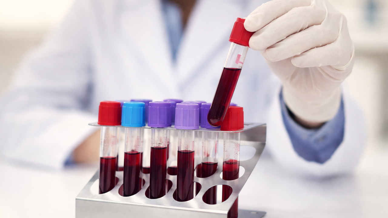 Vivere più a lungo? Un esame del sangue prevede la longevità