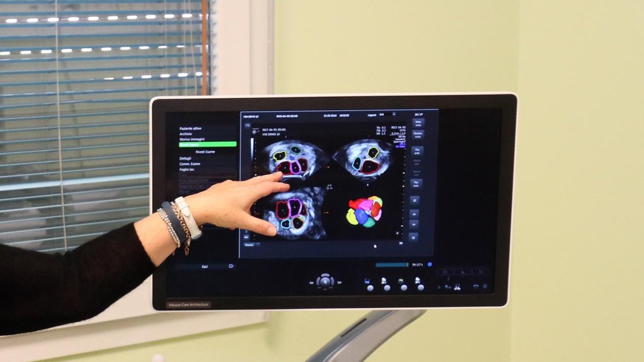 Caso Pma Lagosanto, si dimette la ginecologa: aveva segnalato le anomalie